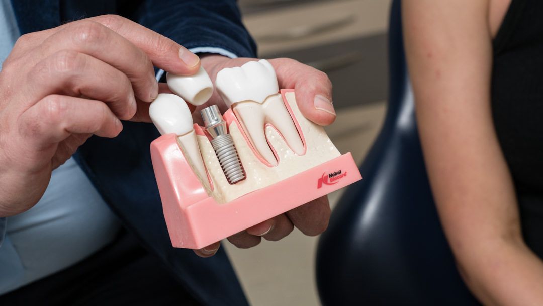 Dental Implants And Flossing: How To Do It The Right Way