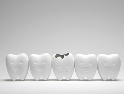 dental-cavities